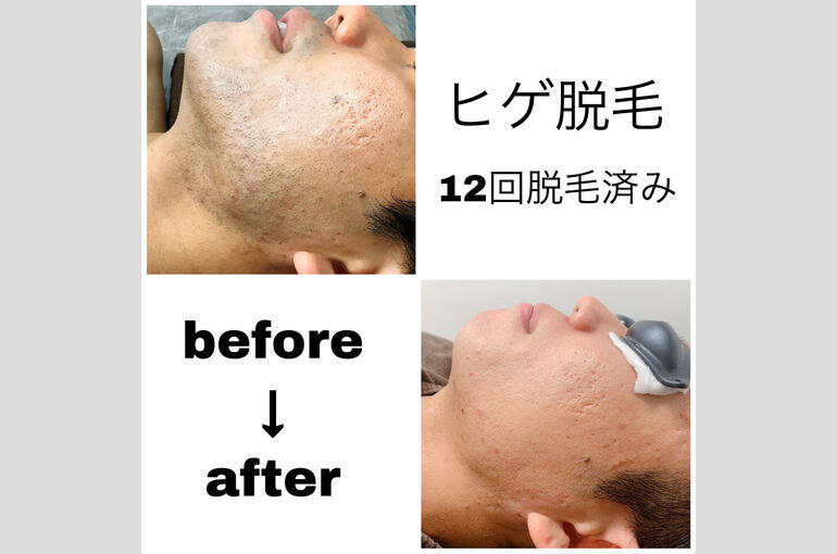 青ひげ